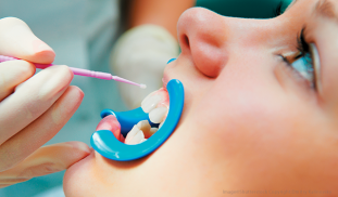 Preventive materials.png