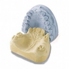 Model dental stone.jpg